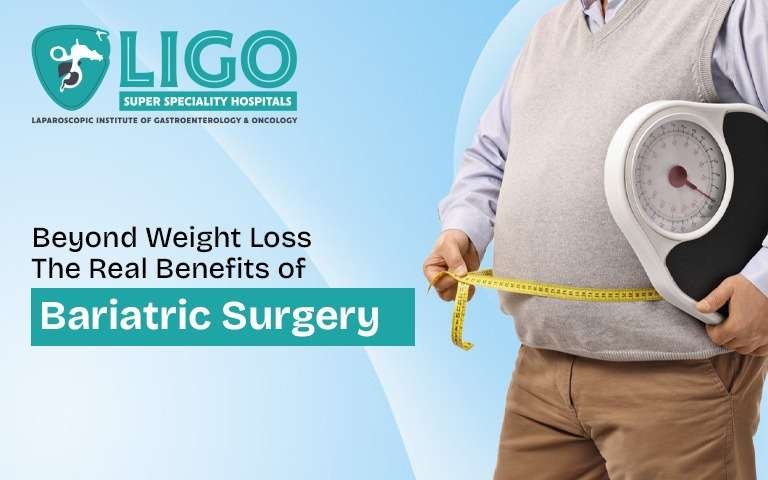 Is bariatric surgery worth the long term health benefits